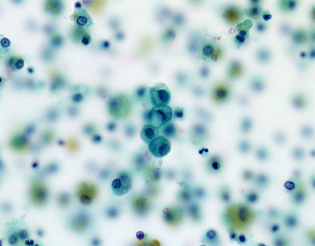 018