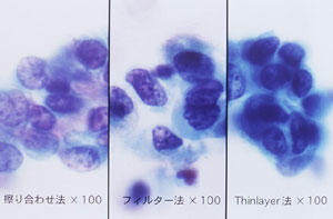 図11