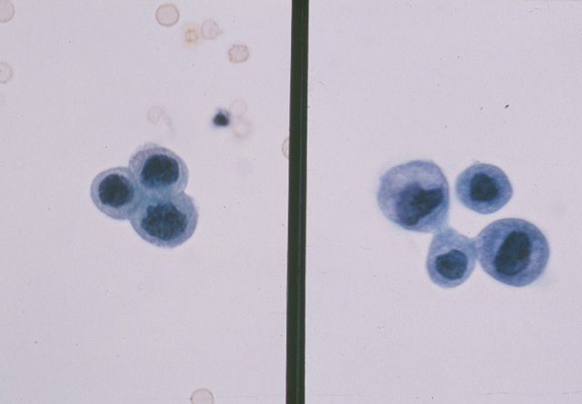 Fig.13igj