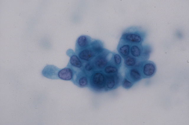 Fig.21（拡大）